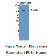 人假尿苷酸合酶1(PUS1)多克隆抗体