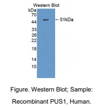 https://msimg.bioon.com/bionline/goods-no-pic.png