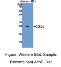 大鼠乙酰胆碱酯酶(ACHE)多克隆抗体