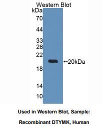 https://msimg.bioon.com/bionline/goods-no-pic.png