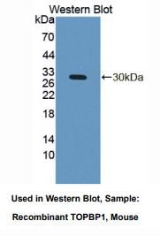 小鼠拓扑异构酶Ⅱ结合蛋白1(TOPBP1)多克隆抗体