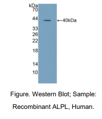 人非组织特异性碱性磷酸酶(ALPL)多克隆抗体