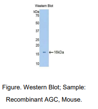 https://msimg.bioon.com/bionline/goods-no-pic.png