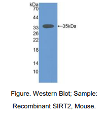 https://msimg.bioon.com/bionline/goods-no-pic.png