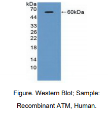 https://msimg.bioon.com/bionline/goods-no-pic.png