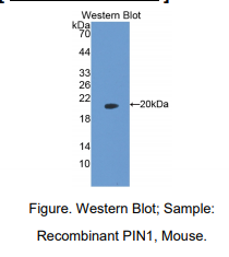 https://msimg.bioon.com/bionline/goods-no-pic.png