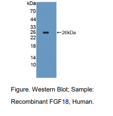 https://msimg.bioon.com/bionline/goods-no-pic.png