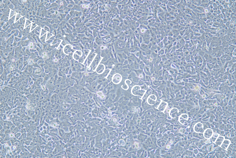 KU-19-19细胞/KU19-19细胞/KU1919细胞/KU-1919细胞/人膀胱移行细胞癌细胞