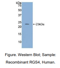 https://msimg.bioon.com/bionline/goods-no-pic.png