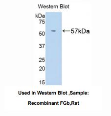 https://msimg.bioon.com/bionline/goods-no-pic.png