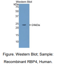 人视黄醇结合蛋白4(RBP4)多克隆抗体