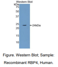 https://msimg.bioon.com/bionline/goods-no-pic.png