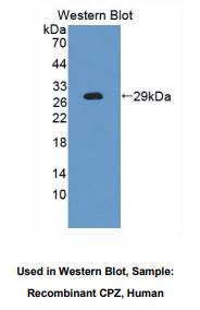 人羧肽酶Z(CPZ)多克隆抗体