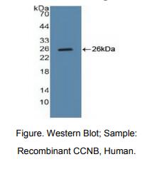 人细胞周期素B(CCNB)多克隆抗体