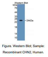 大鼠嵌合蛋白2(CHN2)多克隆抗体
