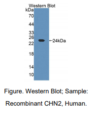 https://msimg.bioon.com/bionline/goods-no-pic.png