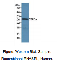 人核糖核酸酶L(RNASEL)多克隆抗体