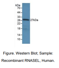 https://msimg.bioon.com/bionline/goods-no-pic.png