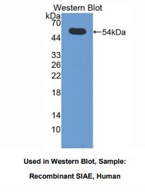 https://msimg.bioon.com/bionline/goods-no-pic.png