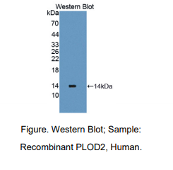 https://msimg.bioon.com/bionline/goods-no-pic.png