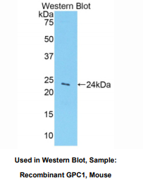 https://msimg.bioon.com/bionline/goods-no-pic.png