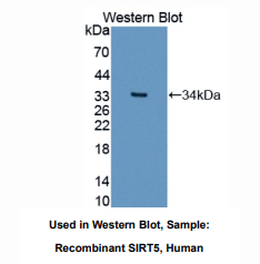 人沉默调节蛋白5(SIRT5)多克隆抗体