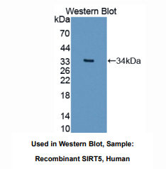 https://msimg.bioon.com/bionline/goods-no-pic.png