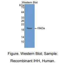 https://msimg.bioon.com/bionline/goods-no-pic.png