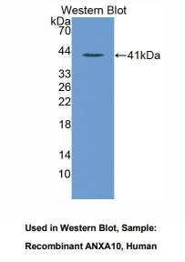 人膜联蛋白A10(ANXA10)多克隆抗体