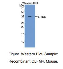 https://msimg.bioon.com/bionline/goods-no-pic.png