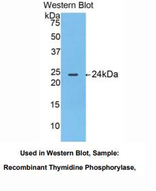 人胸腺嘧啶核苷磷酸化酶(TP)多克隆抗体