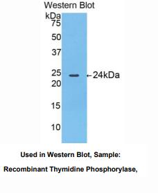 https://msimg.bioon.com/bionline/goods-no-pic.png