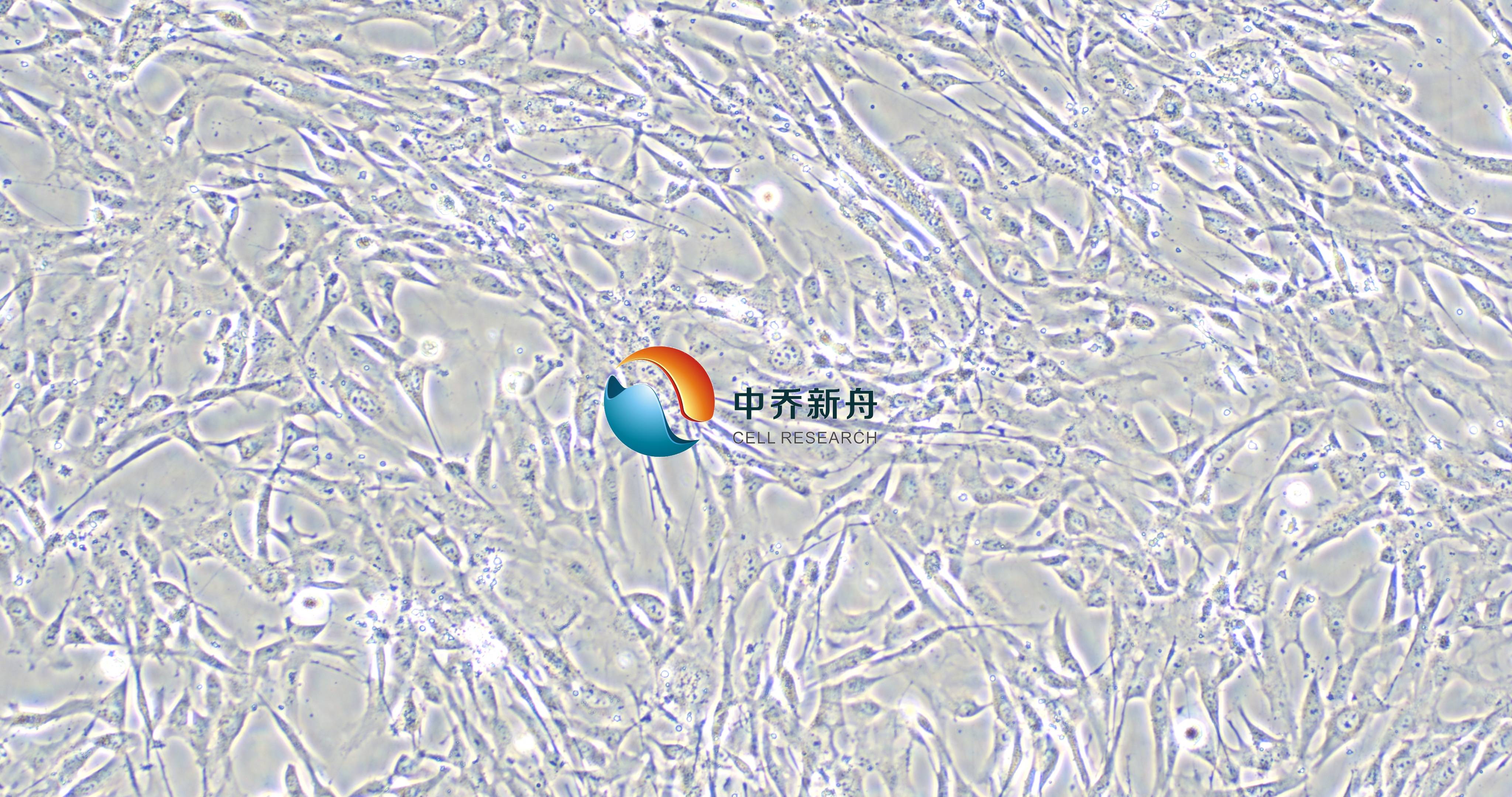 HUMSC-Im-GFP人脐带间充质干细胞永生化-绿色标记