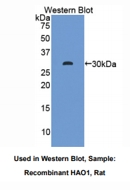 https://msimg.bioon.com/bionline/goods-no-pic.png