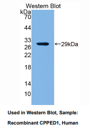 https://msimg.bioon.com/bionline/goods-no-pic.png