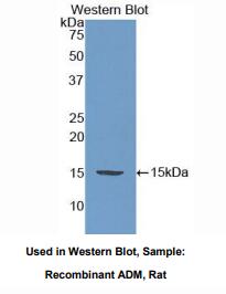 https://msimg.bioon.com/bionline/goods-no-pic.png