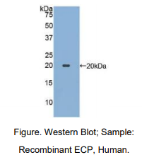 https://msimg.bioon.com/bionline/goods-no-pic.png