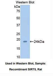 https://msimg.bioon.com/bionline/goods-no-pic.png