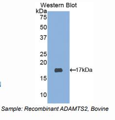 牛血小板反应蛋白解整合素金属肽酶2(ADAMTS2)多克隆抗体