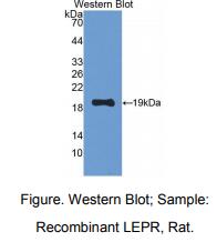 大鼠瘦素受体(LEPR)多克隆抗体