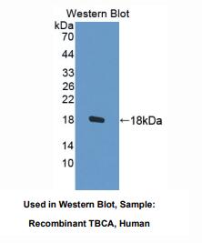 https://msimg.bioon.com/bionline/goods-no-pic.png