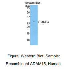 https://msimg.bioon.com/bionline/goods-no-pic.png