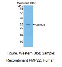 人外周鞘磷脂蛋白22(PMP22)多克隆抗体
