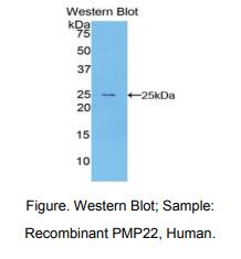 https://msimg.bioon.com/bionline/goods-no-pic.png