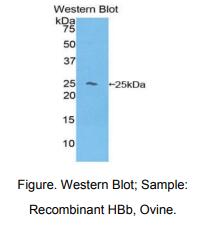 https://msimg.bioon.com/bionline/goods-no-pic.png