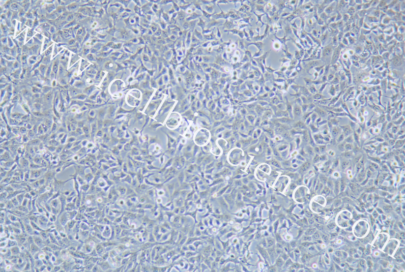 NCI-H1568细胞/NCIH1568细胞/NCI-H1568/NCI-H1568/人非小细胞肺癌细胞