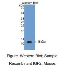 https://msimg.bioon.com/bionline/goods-no-pic.png