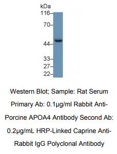 https://msimg.bioon.com/bionline/goods-no-pic.png