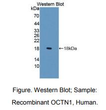 人有机阳离子/麦角硫因转运蛋白(OCTN1)多克隆抗体