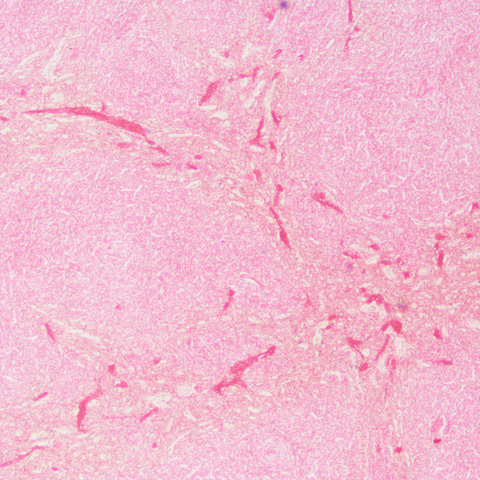 https://msimg.bioon.com/bionline/goods-no-pic.png